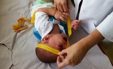 Medio do crnio  um dos exames que indicam m-formaes