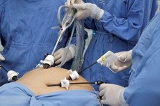 Gastroplastia videolaparoscópica é opção mais utilizada no mundo para a realização da cirurgia bariátrica