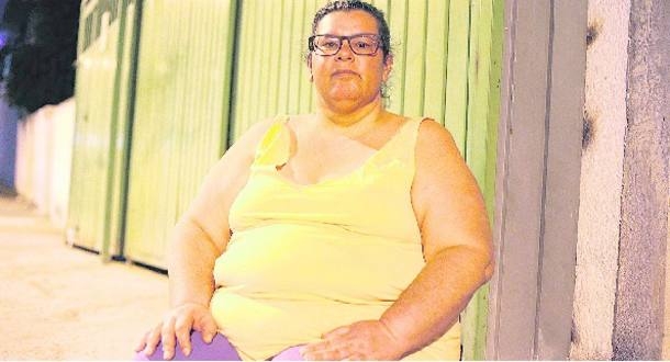 Com obesidade mrbida grau 3, Elisabete tem hipertenso, apneia e dor no joelho.