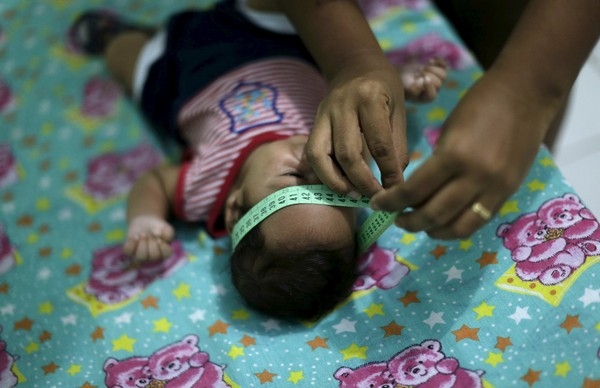 Diagnosticado com microcefalia, bebê Guilherme Soares Amorim, de 2 meses, tem a cabeça medida por sua mãe, Germana Soares, em sua casa em Ipojuca, em Pernambuco