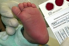 SUS oferece teste do pezinho gratuitamente em maternidades e centros de sade