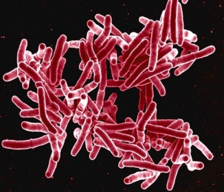 Imagem de microscopia eletrônica mostra a bactéria Mycobacterium tuberculosis, que provocam tuberculose