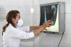 Principal sintoma da tuberculose  a tosse por mais de trs semanas