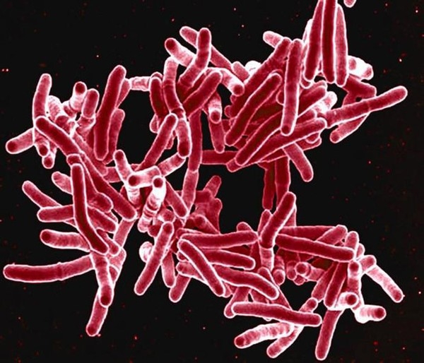 Imagem de microscopia eletrônica mostra a bactéria 'Mycobacterium tuberculosis', o bacilo de Koch, que provoca a tuberculose
