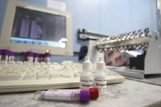 Deciso considerou necessidade de otimizar o diagnstico