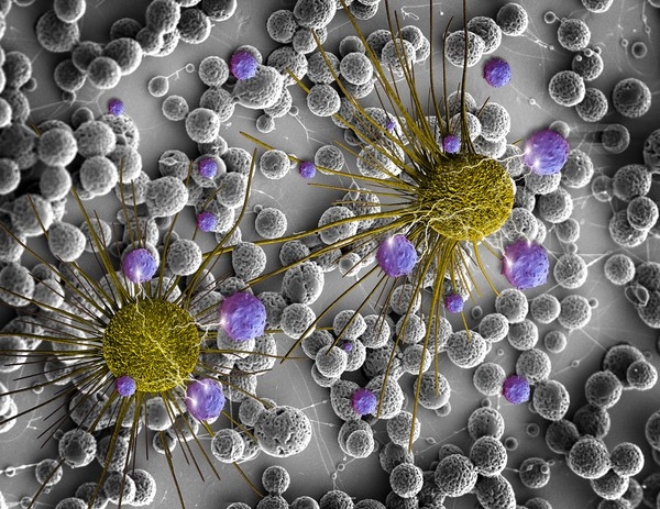 Cientistas buscam por pedaos de DNA do tumor no sangue para detectar cncer