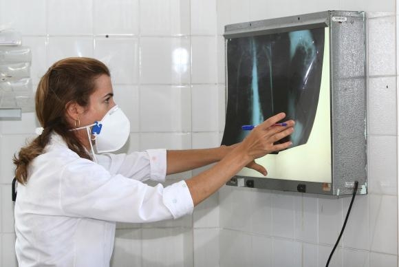  necessrio ficar atento aos sintomas da tuberculose para dar incio ao tratamento e, com isso, interromper a contaminao das outras pessoas