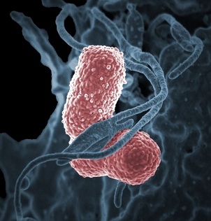 Imagem feita por microscópio eletrônico e colorizada por computador, mostrando a bactéria Klebsiella pneumoniae interagindo com uma célula humana - NIAID/Direitos Reservados