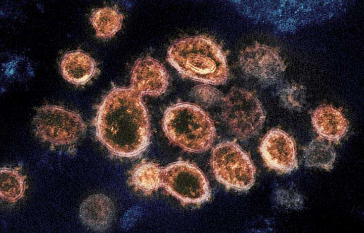 © Vírus SARS-CoV-2 isolados de paciente nos EUA: as protuberâncias externas são as proteínas spike que...