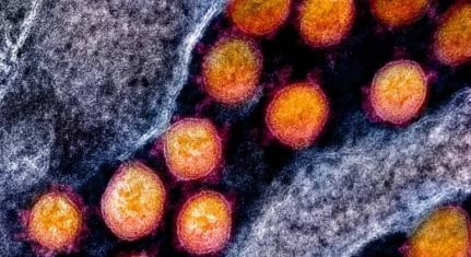 Reproduo/National Institute of Allergy and Infec